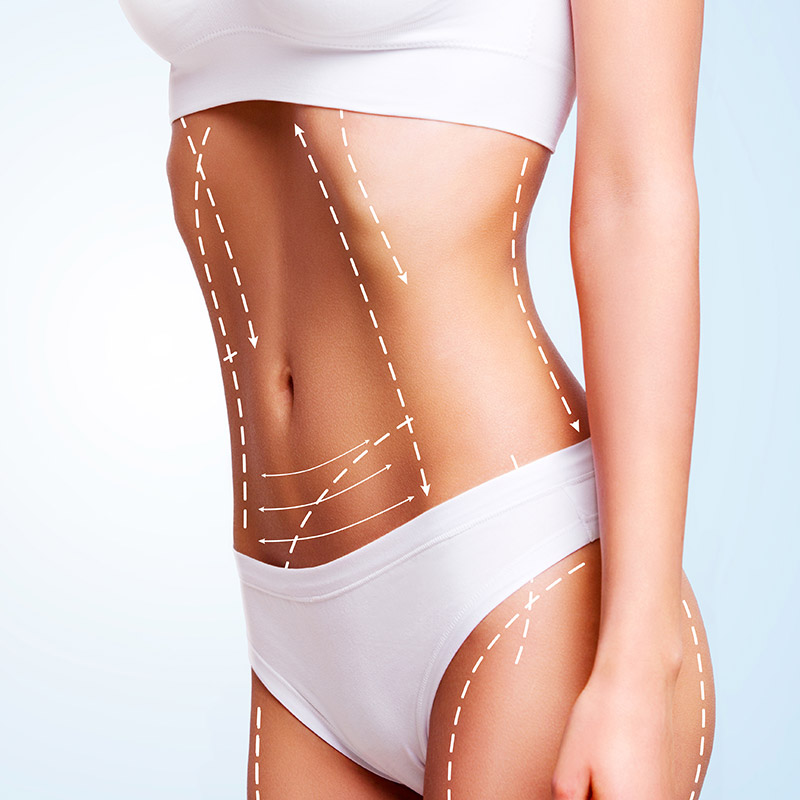 Пластика тела